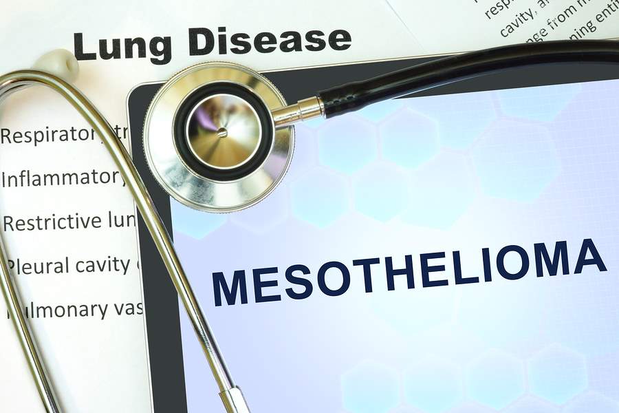 ​How Much Is My Mesothelioma Lawsuit Worth?