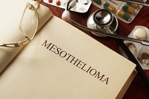 ​​How to Hire a Florida Mesothelioma Lawyer