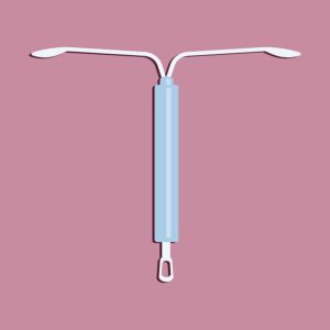 Mirena IUD Lawsuits