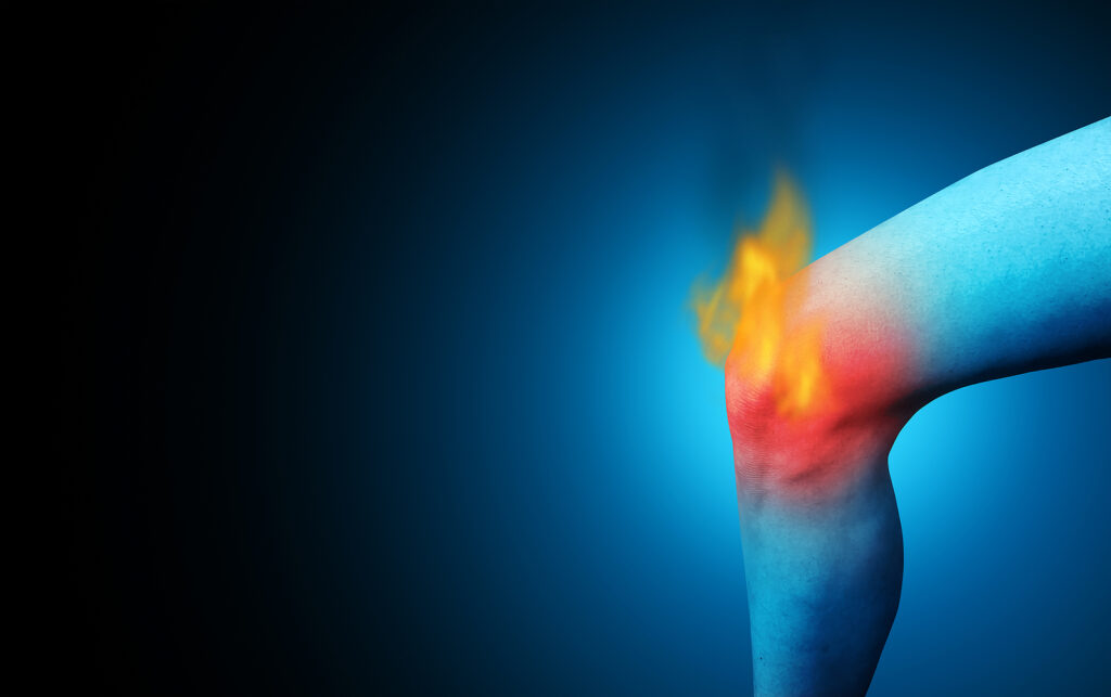 Spring Hill burn injury lawyer