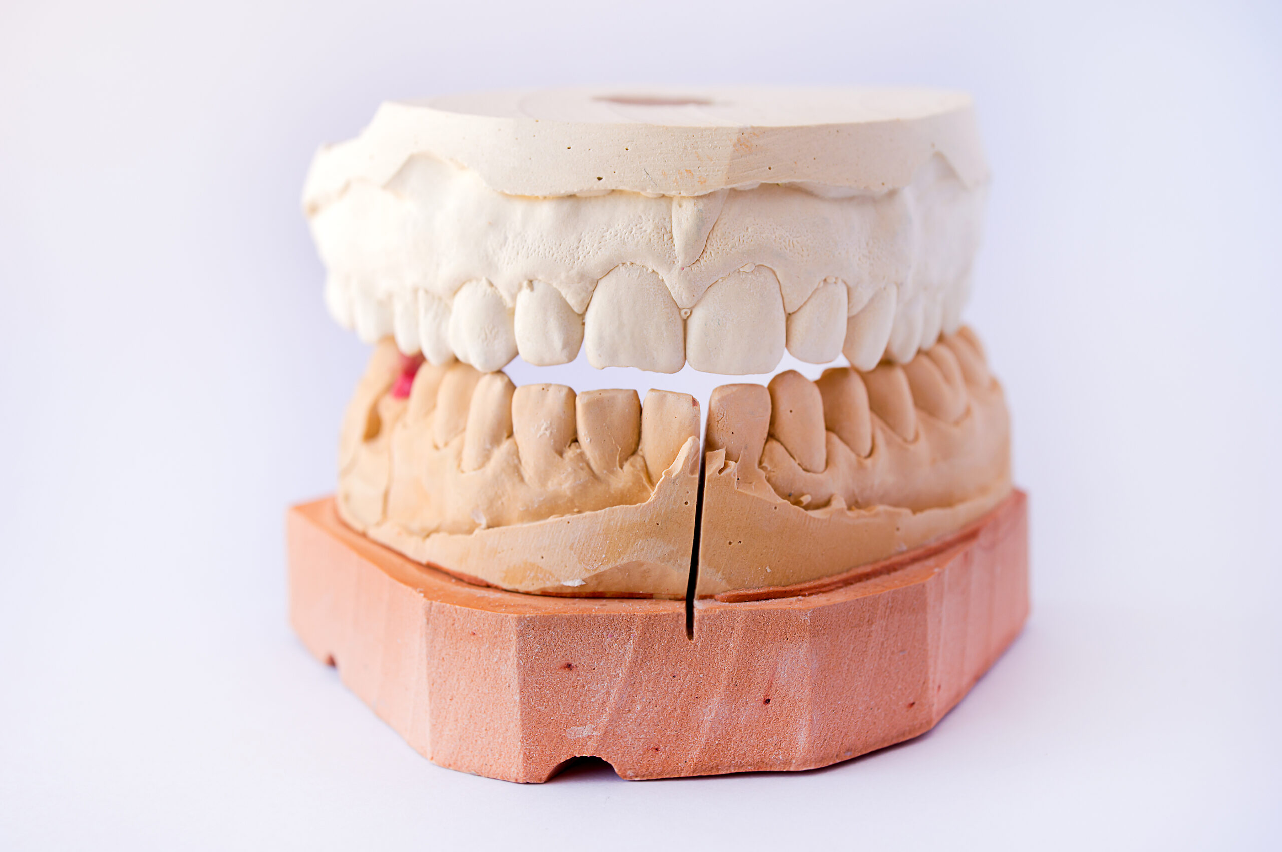 What Causes Suboxone Tooth Decay?